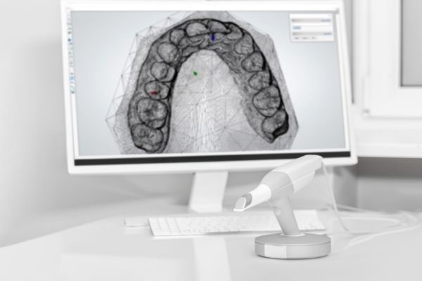 What are Dental Scanners?